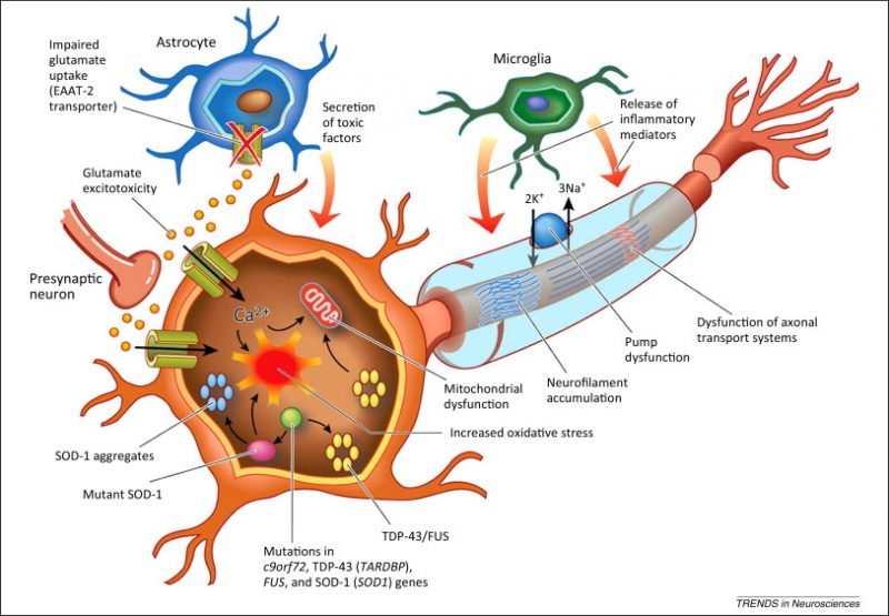 ALS: The Real Story – Cobbers on the Brain